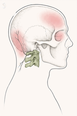 Illustration related to head and neck tension patterns